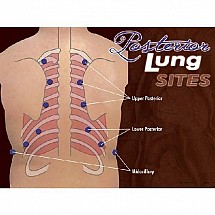 Posterior Lung Sites Poster