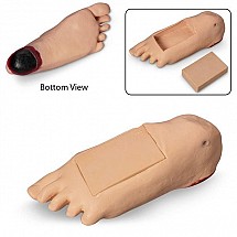 Life/Form Geri and Keri Optional Edema Foot with Deep Tissue Injury, 1/each