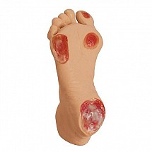 Life/Form Elderly Pressure Ulcer Foot, 1/each