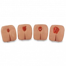 Life/Form Pressure Ulcer Models, 1/each