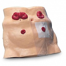 Ostomy Care Model, 1/each