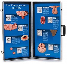 Consequences Of Stds Display, 1/each