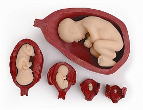 Uterus/Fetus Model Set (5), 1/each