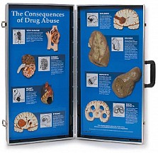 The Consequences of Drug Abuse 3-D Display, 1/each